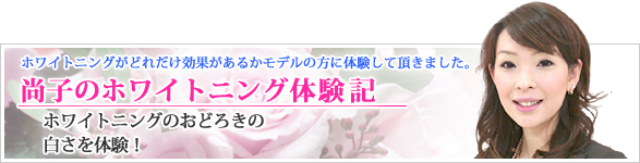 尚子のホワイトニング体験記